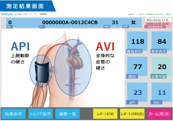 API/AVI測定結果画面・レポート1