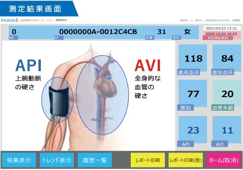 API/AVI測定結果画面・レポート1