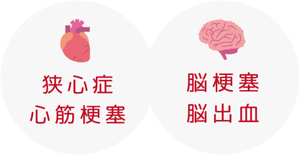 脳梗塞・脳出血・狭心症・心筋梗塞